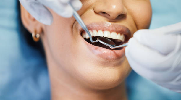 Best Cosmetic Emergency Dentistry in Fairfield, IL